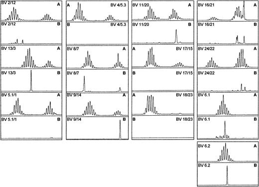 Fig. 4. TCRBV spectratypic profiles from donor 05. / Profiles are for (A) the unselected preculture PBLs and (B) the postculture HCMV pp65–specific HLA-A*0201 tetrameric complex–selected cells. Many BV families had no representative members following tetramer-guided sorting. There was a predominance of 1 or 2 size classes in those families in which representatives were present.