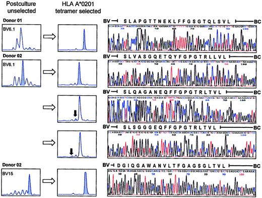 Fig. 9. TCR CDR3 sequence data for clones corresponding to the size class peaks indicated for donor 01 and donor 02 (selected with the HLA-A*0201 tetrameric complex). / There was a lack of conservation of CDR3 length and no evidence of frequent usage of public clonotypes both between the same BV family in different donors (BV6.1 donor 01 and donor 02), different size class peaks from the same BV family in a single donor (BV6.1 donor 02), and different BV families in a single donor (BV6.1 and BV15 donor 02).