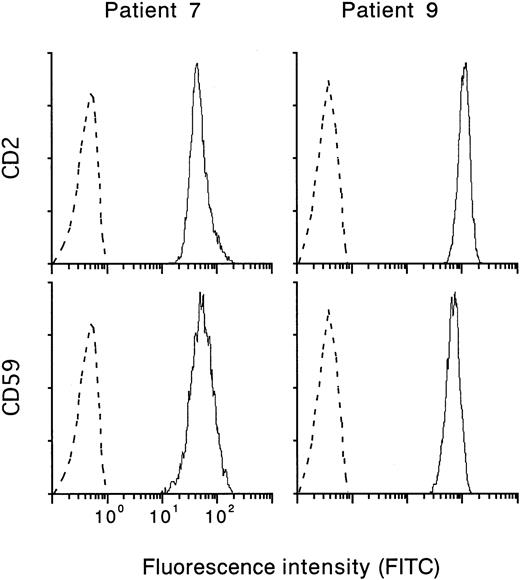 Fig. 3. Expression of CD59 and CD2 on 6-TG–resistant T-cell colonies. / Dotted lines show nonspecific background staining with isotype-matched mouse Ig.