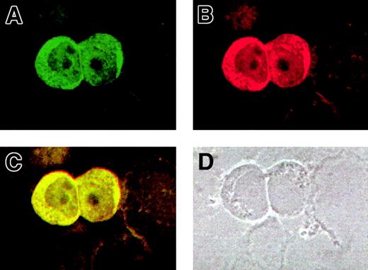 Fig. 5. Colocalization of AF10 and GAS 41 endogenous proteins in KG1a cells by immunofluorescence. / (A) Subcellular localization of AF10, detected with a FITC-conjugated secondary antibody. (B) Subcellular localization of GAS41, detected with a Cy3-labeled secondary antibody. (C). Overlay of the previous images showing colocalization of the 2 proteins, both in the cytoplasm and in the nucleus. (D) Phase contrast image of the same field, showing the presence of cell debris.