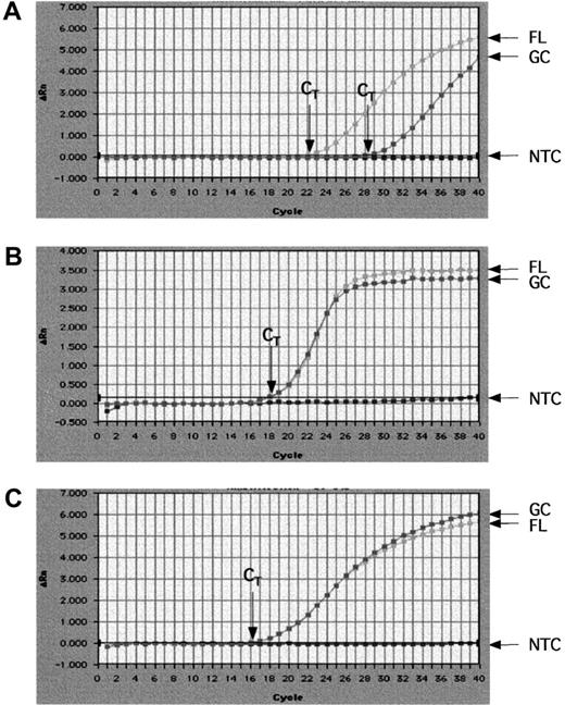 Fig. 2. Real-time RT-PCR quantification for Bcl-2, β-actin, and S9 ribosomal protein mRNAs levels. / Real-time quantitative RT-PCR was performed with appropriate primers for Bcl-2 (A), β-actin (B), and S9 ribosomal protein (C) using SYBR Green I dye. Amplification results were visualized using the Sequence Detector 1.7 software. These are representative plots showing increasing fluorescence (Δ Rn) detected through cycle 40 on normal GC B cell or FL cDNA samples. NTC represents the negative control amplification (using H20 as template). CT represents the threshold cycle at which fluorescence is first detected above background. A higher CT value is indicative of lower mRNA levels (more PCR cycles required to exceed background).