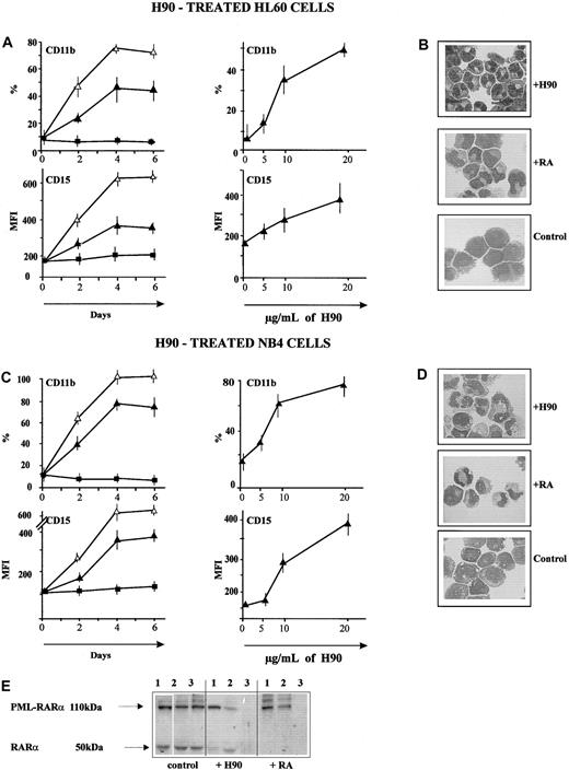 Fig. 2. H90 induces granulocytic differentiation of HL60 and NB4 cells. / (A,C) Increased expression of lineage differentiation antigens. The expression of CD11b, CD14, and CD15 was measured as described in “Materials and methods” and in the legend to Figure 1A. Time and dose-dependency curves are shown. ▪: control; ▴: + H90; ▵: + RA. (B,D) May-Grünwald Giemsa–stained cytosmears of HL60 cells (B) and NB4 cells (D) treated with H90, 10−7 M/L RA, or J173 (controls). Both H90-treated HL60 and NB4 cells showed a segmented nucleus, condensed chromatin, rare nucleoli, and low nucleus-cytoplasmic ratio, all typical for differentiated granulocytic cells (metamyelocytes and band cells) and also observed in RA-treated cells. Magnification: × 630. (E) Degradation of PML-RARα in H90-treated NB4 cells; 24, 48, and 72 hours after addition of H90 (20 μg/mL), PML-RARα and RARα were revealed by successive incubation, first with a 1:2000 dilution of an anti-RAR polyclonal antibody and second with peroxidase-labeled goat antirabbit antibody for detection with ECL chemoluminescence system. The PML-RARα band (approximately 110 kd), present in control NB4 cells, was greatly decreased following addition of H90 (20 μg/mL). This decrease was time-dependent. A similar decrease was observed in RA-treated NB4 cells. The wild-type RARα band (50 kd) was also decreased.