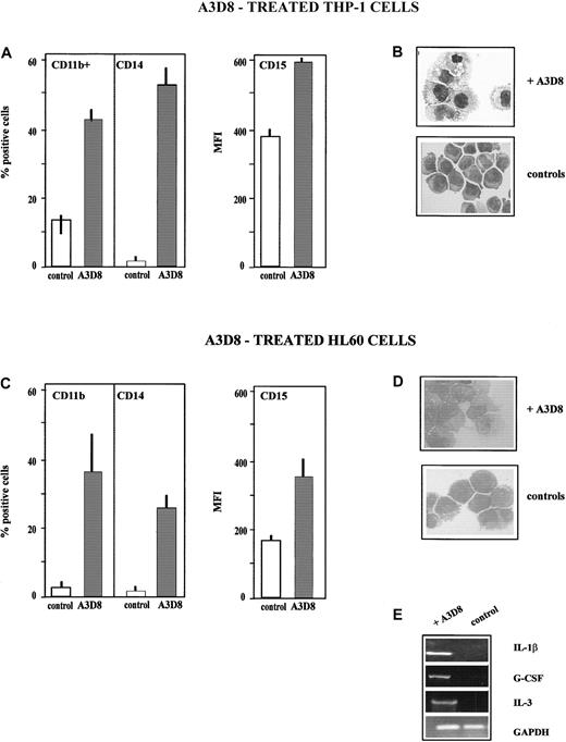 Fig. 4. A3D8 induces monocytic differentiation of THP-1 and HL60 cells. / The data presented in panels A-E have been determined after addition of 2.5 μg/mL A3D8 at day 5 in the case of THP-1 cells (A,B) and at day 6 in the case of HL60 cells (C,D), except cytokine transcript synthesis, which has been analyzed at 24 hours (E). (A,C) Increased expression of lineage differentiation antigens. The expression of CD11b, CD14, and CD15 was measured as described in “Materials and methods” and in the legend to Figure 1A. (B,D) May-Grünwald Giemsa–stained cytosmears. (B) THP-1 cells: control THP-1 cells showed an immature phenotype: high nucleus-cytoplasmic ratio and numerous nucleoli. In contrast, A3D8-treated THP-1 cells showed a decreased nucleus-cytoplasmic ratio, chromatin condensation, and irregular cytoplasmic contours, all typical of mature monocytes. (D) HL60 cells: control cells showed an immature myeloblastic phenotype: high nucleus-cytoplasmic ratio and numerous nucleoli. A3D8-treated cells show a decrease in nucleus-cytoplasmic ratio, chromatin condensation, and irregular cytoplasmic contours typical of mature monocytes. Magnification: × 630. (E) Induction of synthesis of IL-1β, G-CSF, and IL-3 transcripts in HL60 cells. Total RNA from control and treated HL60 cells was prepared as described in “Materials and methods.” Using primers for glyceraldehyde phosphodehydrogenase, the amounts of cDNA were equilibrated to this internal standard. RT-PCR amplification products were separated by 1% agarose gel electrophoresis with 0.5 μg/mL ethidium bromide and were pictured under UV-light irradiation. Twenty-four hours after addition of A3D8, the expression of IL-1β, G-CSF, and IL-3 transcripts was detected. The specificity of the amplification was assessed by Southern blot hybridization with a specific oligonucleotide probe (data not shown). Pretreatment with genistein, a specific inhibitor of tyrosine kinases, abrogated this expression (data not shown).