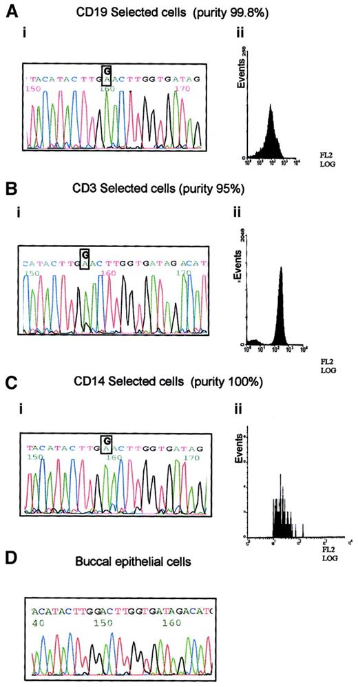 Fig. 2. Prelymphoid origin of G8600A mutation in B-CLL 33. / (A) G8600A mutation in DNA from tumor cells of patient with B-CLL 33 (i), separated to 99.8% purity using CD19 PE-coated magnetic beads (ii). (B) G8600A mutation together with a small peak of a normal sequence in DNA from CD3+ cells of patient with B-CLL 33 (i), separated to 95% purity using CD3 PE-coated magnetic beads (ii). (C) G8600A mutation in DNA from CD14+ cells of patient with B-CLL 33 (i) separated to 100% purity using CD14 labeling and FACS sorting (ii). (D) Absence of G8600A mutation in patient's buccal epithelial cells.