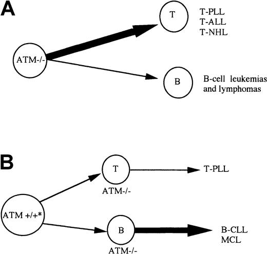 Fig. 6. Model for development of lymphoid malignancies on the background of inherited or acquired. / ATM inactivation. (A) A-T patients with inherited inactivation of both ATM alleles develop both B (B-cell lymphoma) and T-cell tumors, but T-cell tumors are largely predominant. Atm−/− mice develop only T-cell tumors. (B) Individuals with both germline ATM alleles wild type, can acquire complete ATM inactivation during lymphoid development and develop either B-cell malignancies of pregerminal center origin (B-CLL and MCL) or T-cell tumors (T-PLL). * Patients with sporadic B-CLL can be ATM mutation carriers. In contrast to A-T patients with inherited inactivation of both ATMalleles, B-cell tumors are more common than T-cell malignancies in non–A-T individuals.