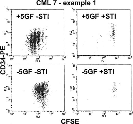 Fig. 4. Effect of STI571 on proliferating Ph+CD34+ cells—CML 7, example 1. / These dot-plots show representative results for a CML sample that proved to be highly sensitive to STI571. As shown in the upper left dot-plot, in the presence of added growth factors, the CD34+ cells were stimulated to proliferate up to 6 times, with associated loss of CD34 expression induced by differentiation. The addition of STI571 (upper right) eradicated almost all the dividing cells, leaving behind only the nonproliferating quiescent fraction. In the absence of growth factors (lower left), the CD34+ cells demonstrated autonomous growth (compared with the normal control in Figure 3) with up to 4 divisions and with retention of CD34 expression. The addition of STI571 (lower right) once again eradicated all cells that entered cell division.