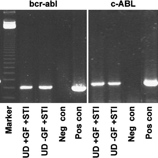 Fig. 5. Genotyping of quiescent CD34+ cells resistant to STI571. / Representative RT-PCR (CML 3) demonstrating that the undivided population expressed transcripts for BCR-ABL, whether recovered from cultures with or without added growth factors. Lane 1, markers; lanes 2-5, BCR-ABL; lane 2, undivided cells from +GF culture with added STI571; lane 3, undivided cells from −GF culture with added STI571; lane 4, negative control (Neg con); lane 5, positive control (Pos con); lanes 6-9, c-ABL loading controls.