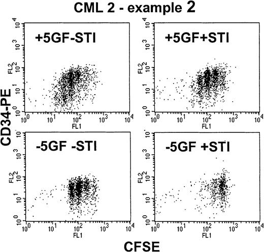 Fig. 6. Effect of STI571 on proliferating Ph+CD34+ cells—CML 2, example 2. / These dot-plots show representative results for a CML sample that proved to be relatively insensitive to STI571 despite more than 95% of the input cells being BCR-ABL+ by FISH. As shown in the upper left dot-plot, in the presence of added growth factors, the CD34+ cells were stimulated to proliferate up to 6 times. The addition of STI571 (upper right) reduced the number of division peaks to 4 and increased the proportion of cells in the undivided peak. In the absence of growth factors (lower left), the CD34+cells demonstrated autonomous growth with up to 3 divisions and with retention of CD34 expression. The addition of STI571 (lower right) reduced the division peaks to 2 with most cells found in the undivided fraction.