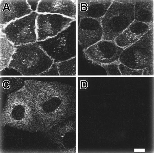 Fig. 4. Expression of normal KB3 and KB3 Walton in transfected MDCK cells. / MDCK cells stably transfected with KB3 (A,B) or KB3 Walton (C,D) were treated for immunofluorescence using the antiband 3 Bric170 (A,C) or the antiband 3 Bric155 (B,D) and fluorescein isothiocyanate–conjugated rabbit antimouse secondary antibody as described in “Patients, materials, and methods.” The cells were imaged using confocal microscopy. Representative fields of view are shown. Bright field microscopy showed that all the cells in fields A through C were reactive with the antibody and fields C and D contained a similar number of cells. Bar = 10 μM.