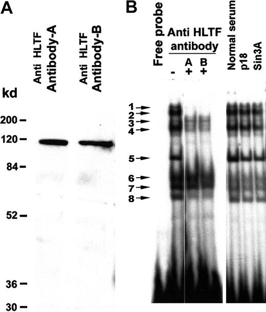 Fig. 3. HLTF is present in several major DNA-protein complexes formed on the PCS. / (A) Western blot of the K562 nuclear extract with HLTF antibody A and B shows a prominent band of 115 kd. A minor faint band below may be the degradation product. K562 nuclear extract (50 μg) was resolved on a 12% SDS-PAGE. The HLTF antibodies are indicated on the top, and the molecular weight markers are indicated at the left-hand side. (B) EMSA with 32P-labeled PCS oligonucleotide (oligo 1) and K562 nuclear extracts in the presence (+) and absence (−) of HLTF antibodies A and B. Normal rabbit serum and antibodies against p18 Maf and Sin3A served as control. In a standard 20-μL EMSA reaction mixture, 2 μL each of the antibody mentioned at the top of the panel and 5 μg nuclear extracts were preincubated for 10 minutes before the addition of the 32P-labeled DNA probe. The binding mix was incubated for an additional 10 minutes at room temperature after the addition of the DNA probe and analyzed on a 5% polyacrylamide gel.