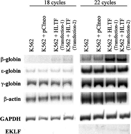Fig. 8. RT-PCR of total RNA from normal and HLTF-overexpressing K562 cells. / RT-PCR conditions are described in the “Materials and methods” section. After 18 (left) or 22 (right) cycles, the PCR products were run on a 6% polyacrylamide gel for 2.5 hours, dried, and exposed to x-ray film. The data are representative of 3 independent experiments. K562 + HLTF transfection-1 and transfection-2 are the 2 pools of K562 cells stably transfected with pCIneo containing HLTF in 2 independent transfections. The exposure times were adjusted for each set of PCR to obtain bands of optimum intensity. The autoradiogram exposure times are as follows: 16 hours at room temperature (RT) for β-globin, 12 hours at −80°C for EKLF, 5 hours at RT for ε-globin, 15 minutes at RT for γ-globin, 1 hour at RT for β-actin, and 0.5 hours at RT for GAPDH.