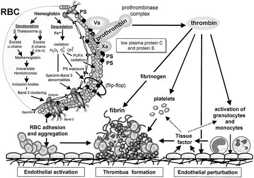 Fig. 1. The hypercoagulable state in thalassemia. / Thalassemia is associated with partial or complete deficiency of α- or β-globin chain synthesis, which leads to denaturation and degradation of the remaining globin chains. This process is associated with loss of the normal asymmetrical distribution of the RBC membrane phospholipids and translocation of PS to the external membrane leaflet (flip-flop). The membrane damage may be related to lipid peroxidation mediated by free iron and increased amounts of membrane-bound hemichromes and immunoglobulins and modifications in the membrane band 3 protein and spectrin. The membrane changes may partly explain the enhanced aggregation of PS-exposing RBCs, their increased adherence to ECs, and their capacity to enhance thrombin generation via the assembly of the prothrombinase complex. The enhanced thrombin generation leads to activation of platelets, monocytes, granulocytes, and ECs and expression of tissue factor, which further enhances the thrombotic process. The low levels of the coagulation inhibitors, protein C and protein S, further facilitate the resultant hypercoagulable state.