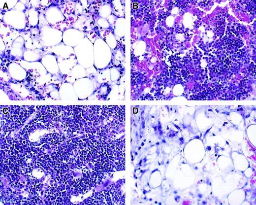 Fig. 4. Histologic analysis of bone marrow from transplant recipients. / Hematoxylin and eosin staining; original magnification, ×100. Representative bone marrow changes in allogeneic full-term fetal blood recipients are shown. Bone barrow was obtained 14 to 15 days after treatment. (A) Radiation only. (B) Allogeneic T-cell–depleted bone marrow. (C) Allogeneic T-cell–depleted bone marrow plus T cells. (D) Allogeneic full-term fetal blood.