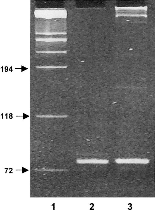 Fig. 3. CD138+ plasma cells belong to the same neoplastic clone than fresh malignant B cells as evidenced by IgH gene rearrangements. / Fr3 PCR products of DNA samples were obtained from fresh malignant B cells and from purified CD138+ cells after 21 days of the CD4+ T/B-cell coculture. Lane 1, molecular weight markers (sizes in base pairs); lane 2, fresh malignant B cells; lane 3, purified CD138+ cells. Results are from 1 representative experiment of the 2 performed.