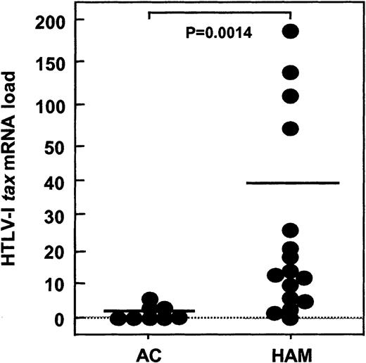 Fig. 3. HTLV-I. / tax mRNA load in HAM/TSP patients and ACs. HTLV-1 tax mRNA load was assessed in PBMCs from 16 HAM/TSP patients (HAM) and 8 asymptomatic HTLV-I carriers (AC). HTLV-1tax mRNA load was significantly higher (P = .0014) in HAM/TSP patients compared to ACs.