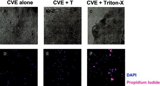 Fig. 5. T-cell–induced damage to CVE monolayers. / CVEs were cultured 18 to 20 hours alone (A, D), with PLP139-151–specific Th1 cells and no antigen (B, E), or with 0.02% Triton X-100 (C, F). (A-C) Representative pictures were taken using a Nikon N90 AF 35-mm camera and scanned into Adobe Photoshop using Polaroid Insight for analysis (original magnification, 200×). (D-F) Monolayers were then washed and stained with DAPI (blue) and PI (red) to quantitate the total number of cells and the number of dead cells, respectively. Slides were examined and images were acquired through epifluorescence using the SPOT RT camera, and they were analyzed with Metamorph Imaging Software.