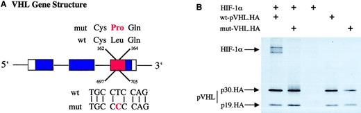 Fig. 2. Mutation analysis of tumor DNA reveals a point mutation in exon 3 of the VHL gene that loses the ability to bind HIF-1α. / Mutational analysis of genomic tumor DNA revealed a point mutation of the VHL gene in exon 3 at position 701. (A) The position of this mutation in relation to the intron/exon (boxes) boundaries and the functional domains of pVHL; α-domain, red; and β-domain, blue. Amino acid (top) and nucleotide (bottom) sequences are shown for wild-type (wt) and mutated (mut) VHL, illustrating the exchange of amino acid 163, leucine to proline. (B) An immunoprecipitation assay in which 10 μL of each radioactive in vitro–transcribed and –translated product of HIF-1α, wild-type pVHL (wt-pVHL.HA), and mutated pVHL (mut-pVHL.HA, Leu163Pro) were coincubated. HA tag–fused C-terminal to pVHL was used to immunoprecipitate pVHL with its potential binding partner using a specific anti-HA monoclonal antibody. Crosses indicate the input of respective proteins into the reaction. Immunoprecipitates were denatured and separated by sodium dodecyl sulfate–polyacrylamide gel electrophoresis. Visualization was achieved by autoradiography. Arrows indicate HIF-1α and both positions of pVHL, full-length (p30.HA) and the truncated protein fragment, caused by an internal translation initiation site (p19.HA). Whereas wild-type pVHL.HA coimmunoprecipitates with HIF-1α, the mutated protein L163P shows no binding to HIF-1α.