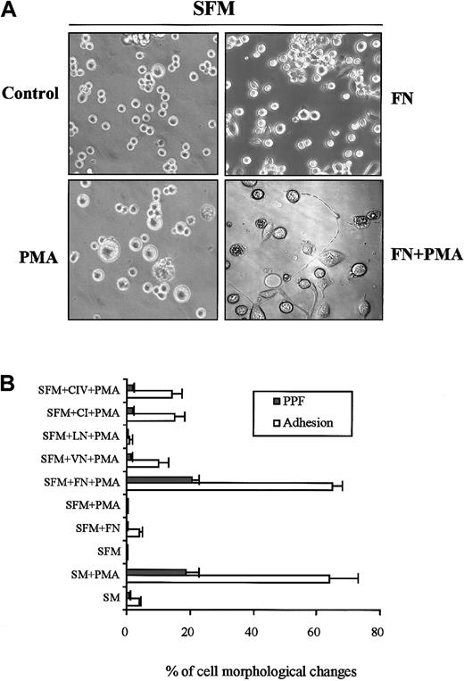 Fig. 2. Effect of single matrix protein on CHRF cell morphology with or without PMA treatment in serum-free medium culture. / (A) Cells cultured in serum-free medium with different combinations. Full cell differentiation, including PPF, occurred only in FN/PMA costimulation. Original magnification × 200. (B) Culture dishes were coated with a single matrix protein (50 μg/mL) overnight. Cells were cultured in serum-free medium in the presence of PMA (10 ng/mL) and a single matrix protein for 3 days. Cells were seeded at a concentration of 2.5 × 104 cells per milliliter and counted in 1-mm2 areas by means of phase contrast microscopy. SM, serum-containing medium; SFM, serum-free medium. Graph depicts the means ± SE from at least 5 experiments.