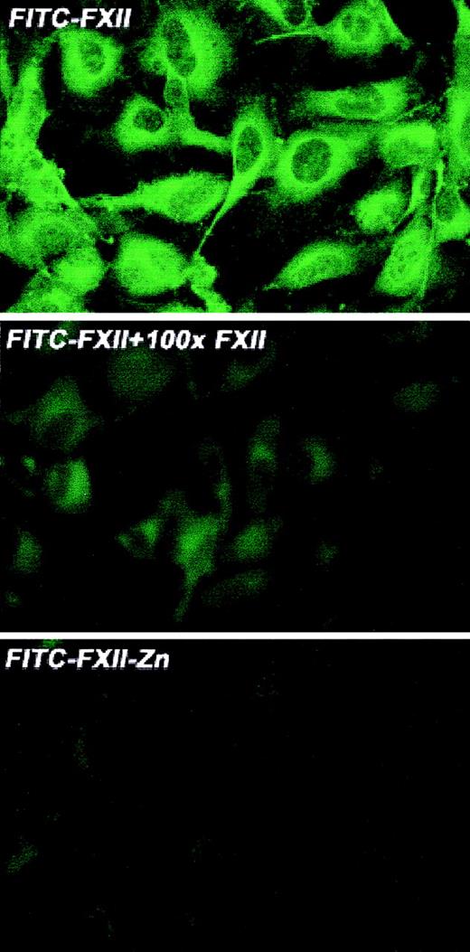 Fig. 4. Laser scanning confocal microscopy of FITC-FXII binding to HUVECs. / Nonpermeabilized, paraformaldehyde (2%)–fixed HUVECs were grown on microscope slides. HUVECs were incubated with 300 nM FITC-FXII in HCB in the presence or absence of 10 μM ZnCl2 or 100-fold molar excess of unlabeled FXII for 1 hour at 37°C. Detection of FITC-FXII on the HUVECs is described in “Materials and methods.” The panels are photomicrographs of the laser scanning confocal microscopy. The figure is a representative presentation of 3 independent experiments.