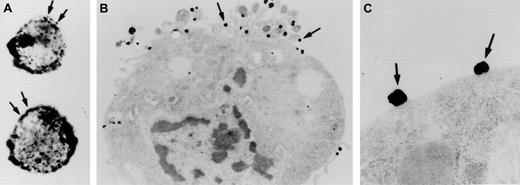 Fig. 5. Visualization of Nanogold-FXII on EA.hy926 endothelial cells. / Cell suspensions were incubated for 60 minutes at 37°C with 210 nM Nanogold-FXII in HCB, pH 7.4, containing 10 μM Zn2+, and then gold particles were enhanced with silver. Panel A shows the silver-enhanced FXII (arrows) at the light microscopic level. Panel B represents a low-power electron microscope view of an endothelial cell with clusters of silver-enhanced FXII on the cell surface (arrows). Panel C shows a high magnification of the irregular silver-enhanced Nanogold-FXII particles (arrows).