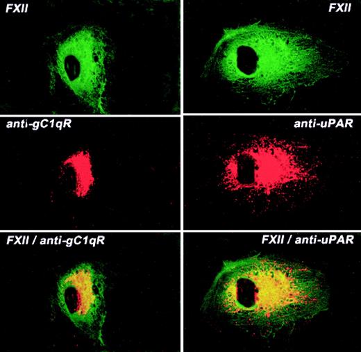 Fig. 7. Colocalization of FITC-FXII with uPAR or gC1qR on HUVECs. / Nonpermeabilized, paraformaldehyde (2%)–fixed HUVECs were grown on microscope slides. HUVECs were incubated in HCB containing 10 μM ZnCl2 with 300 nM FITC-FXII in the presence of anti-gC1qR (4 μg/mL) or anti-uPAR (4 μg/mL) antibodies for 1 hour at 37°C. The dual detection of the antigens was performed with a secondary antibody labeled with Alexa Fluor 594–labeled goat antimouse IgG conjugate (10 μg/mL) and FITC-FXII as described in “Materials and methods.” The panels are photomicrographs of the laser scanning confocal microscopy. The figure is a representative presentation of 3 independent experiments.