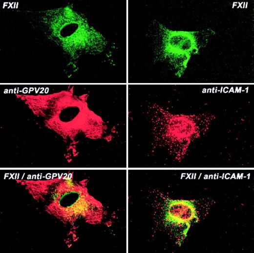 Fig. 8. Colocalization of FITC-FXII with CK1 or ICAM on HUVECs. / Nonpermeabilized, paraformaldehyde (2%)–fixed HUVECs were grown on microscope slides. HUVECs were incubated in HCB containing 10 μM ZnCl2 with 300 nM FITC-FXII in the presence of anti-GPV20 (300 μg/mL) or anti-ICAM-1 (4 μg/mL) antibodies for 1 hour at 37°C. The dual detection of the antigens was performed with secondary antibodies labeled with Alexa Fluor 594–labeled donkey antigoat IgG (H+L) conjugate (10 μg/mL) or Alexa Fluor 594–labeled goat antimouse IgG (10 μg/mL) and FITC-FXII as described in “Materials and methods.” The panels are photomicrographs of the laser scanning confocal microscopy. The figure is a representative presentation of 3 independent experiments.