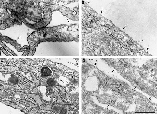 Fig. 5. PF4 promotes aggregation of LDL on the cell surface, outside coated pits. / Electron micrographs of fibroblasts incubated with 5 nM Au-LDL alone (A,C) or 5 nM Au-LDL in the presence of 20 μg/mL PF4 (B,D) for 30 (A,B) or 120 (C,D) minutes at 37°C. The size of the Au particles used was 18 nm. At 30 minutes (A,B) most Au-LDL (arrow) is on the cell surface. In the absence of PF4, LDL is seen in coated pits, whereas, when PF4 is present, LDL was exclusively located outside coated pits. At 120 minutes LDL is primarily located intracellularly in the absence of PF4 (C). LDL is present in clusters on the cell surface in the presence of PF4 (D, arrowhead). The micron bar corresponds to 500 nm. Shown are representative images from 2 or more independent experiments.