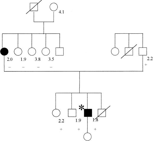 Fig. 2. Pedigree of patient with mutation TM del791-801. / The propositus is indicated by an asterisk; filled symbols indicate the presence of thrombosis, a crossed symbol indicates a deceased individual. The numbers at the right of the symbols represent the value of APC ratio, and the + or (minus) sign indicates the presence or absence of the TM mutation, respectively.