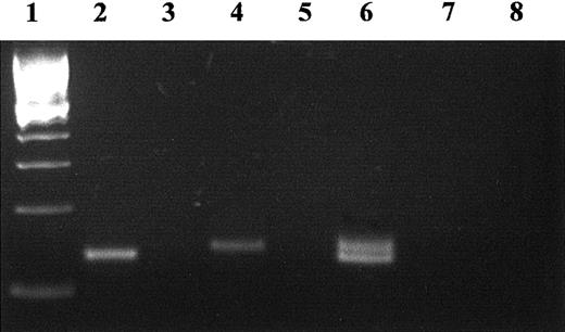 Fig. 4. RT-PCR of the mRNA for mutant TM del791-801 and wild type from the transiently transfected COS-7 cells. / Total RNA was reverse transcribed with random primers and the cDNA used as a template for PCR amplification with 2 TM primers flanking the deleted region. The size of the normal product is 143 bp (lane 4). The deletion gives rise to a smaller, 132-bp product (lane 2). Both transcripts were detected in cells cotransfected with both TM variants (wild-type and mutant, lane 6). The 100-bp marker (Life Technologies) was loaded in lane 1. Negative controls without reverse-transcriptase (lanes 3, 5, 7) or without template (lane 8) were included.
