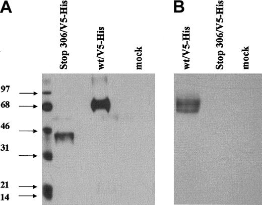 Fig. 5. Western blot of the expressed del791-801 TM. / Transient transfections of COS-7 cells were performed using the wild-type or mutated TM expression vector with a V5 tag sequence attached adjacent to the STOP codons. Proteins in whole cell lysates prepared by addition of Laemmli buffer to cells (A) or in detergent extracts of the cells (B) were separated by SDS-polyacrylamide gel electrophoresis (SDS-PAGE) under nonreducing conditions. Immunodetection was performed using an anti-V5 tag antibody.
