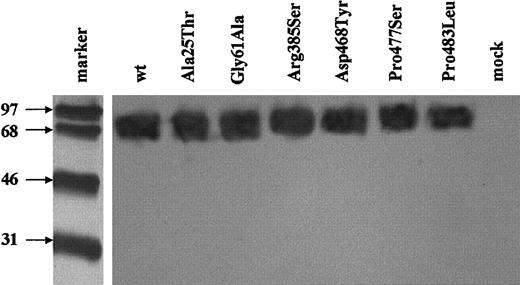 Fig. 6. Western blot of the expressed missense TM mutants. / SDS-PAGE under nonreducing conditions and immunoblotting of cell lysates expressing each of the mutants or the wild-type TM were carried out. Immunodetection was performed with sheep polyclonal anti-TM antibody followed by HRP-conjugated antigoat antibody and ECL detection. The molecular weight markers were reduced and following electroblotting were detected separately with streptavidin-HRP conjugate.