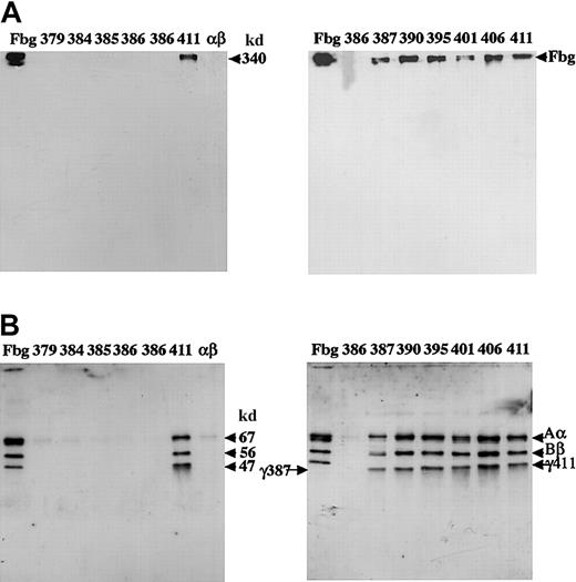 Fig. 2. Western blot analysis of the culture medium. / Samples of medium (5 μL) were subjected to 8% SDS-PAGE under nonreduced conditions (A) or 10% SDS-PAGE under reduced conditions (B). The blots were developed with a polyclonal antibody to fibrinogen and cross-reacting bands detected by chemiluminescence, as described in “Materials and methods.” Plasma fibrinogen (3 ng) was run in lanes labeled Fbg; medium from individual CHO lines were in lanes labeled 379: γ379-1; 384: γ384-33; 385: γ385-24; 386: from left to right, γ386-20, -37, and -39; 411: γ411-31; αβ: AαBβ-CHO cells; 387: γ387-5; 390: γ390-16; 395: γ395-2: 401: γ401-25; 406: γ406-7. Arrows at 340 kd, or 67 kd, 56 kd, and 47 kd indicate intact fibrinogen (A) or the normal Aα, Bβ, and γ chains (B). Arrows labeled γ387 and γ411 indicate this truncated and normal γ chain, respectively (B).