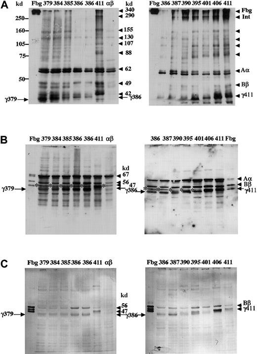 Fig. 3. Western blot analysis of CHO cell lysates. / Lysates were subjected to 8% SDS-PAGE under nonreduced conditions (A) or 10% SDS-PAGE under reduced conditions (B,C). Blots were developed with an antibody to fibrinogen (A,B) as described in the legend to Figure 2, or with a polyclonal antibody reacting with the fibrinogen Bβ and γ chains (C), as described in “Materials and methods.” Cross-reacting bands were detected by peroxidase-catalyzed chemiluminescence (A,B) or by alkaline phosphatase–catalyzed color development (C). The samples were as described in Figure 2 except the plasma fibrinogen (lanes Fbg) was 30 ng (C). Arrows labeled γ411, γ379, and γ386 indicate normal and truncated γ chains. The 47-kd band indicated with asterisk (B) was present in AαBβ-CHO cells.