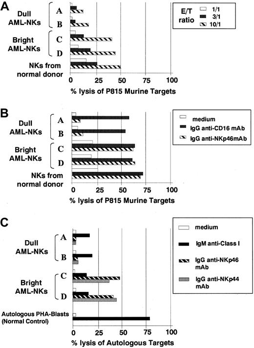 Fig. 2. Cytolytic activity of NK cells derived from patients with acute leukemia. / Cultured AML-NK cells at diagnosis were tested, in comparison with control NKs from a healthy donor, for cytotoxicity against P815 murine target (A,B). (A) The spontaneous NK-mediated cytotoxicity was evaluated at different effector-to-target ratios (10:1, stripped bars; 3:1, black bars; 1:1, white bars). (B) NK cells were analyzed in redirected killing experiments either in the absence (white bars) or in the presence of IgG1 mAb directed to anti-CD16 (black bars) or anti-NKp46 (stripped bars) mAbs, at an effector-to-target (E/T) ratio 3:1. (C) The same 4 representative AML-NK cells were assessed for cytolytic activity against autologous AML blasts either in the absence (white bars) or presence (black bars) of an anti-HLA class I mAb (of IgM isotype) at an E/T ratio of 10:1. The same effector and target cells were also tested in the presence of anti-NKp46 (striped bars) or anti-NKp44 (shaded bars) of IgG1 isotype in a redirected killing assay in which the mAb is substituting the natural ligands for the receptors. The normal control is represented by a polyclonal NK cell population derived from a healthy individual that has been assessed for cytotoxicity against autologous PHA blasts. These panels are representative of 3 different experiments, and similar results were obtained with NK cells from 8 additional AML patients.