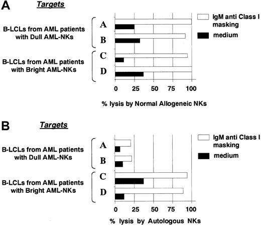 Fig. 4. Killing of B-LCLs derived from leukemic patients by normal allogeneic or autologous NK cells. / (A) The same normal NK cell population reported in Figure 3 was assessed for cytotoxicity against 4 different B-LCLs derived from the same 4 representative patients. (B) B-LCLs were assessed for susceptibility to killing by autologous AML-NK cells. In both cases the cytolytic assays were performed either in the absence (black bars) or in the presence (white bars) of anti-HLA class I mAb. The E/T ratio was 12:1. This experiment is representative of 3 independent assays.