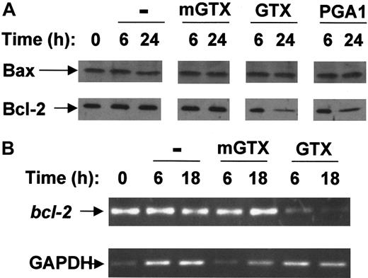 Fig. 3. Complete NF-κB inhibition results in Bcl-2 down-regulation in resting human blood B cells. / (A) Blood B cells were isolated from buffy coats by negative magnetic selection and cultured for 6 hours and 24 hours in the presence or absence of 1.5 μM mGTX, 1.5 μM GTX, or 48 μM PGA1. Whole-cell extracts were analyzed by immunoblotting for Bax and Bcl-2 expression. (B) RNA prepared from blood B cells cultured for 6 hours and 18 hours in the presence or absence of 1.5 μM mGTX or 1.5 μM GTX was analyzed by RT-PCR for expression of bcl-2. To control for quantification, GAPDH was amplified. These results represent at least 3 comparable experiments.