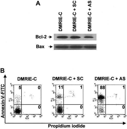 Fig. 7. Antisense knockdown of bcl-2 leads to drastic human blood B-cell apoptosis. / Blood B cells were isolated from buffy coats by negative magnetic selection, cultured, and treated for 24 hours with DMRIE-C alone (24 μL per 2 × 106 cells) or DMRIE-C combined withbcl-2 AS or SC ODNs (8 μg per 2 × 106cells). (A) Whole-cell extracts were analyzed by immunoblotting for Bcl-2 and Bax. (B) Alternatively, apoptosis assays using dual-color annexin-V–FITC/PI staining and flow cytometry analyses were performed on treated B cells. The percentage of single- or double-positive cells in the individual quadrants is shown. These results were representative of at least 3 comparable experiments.