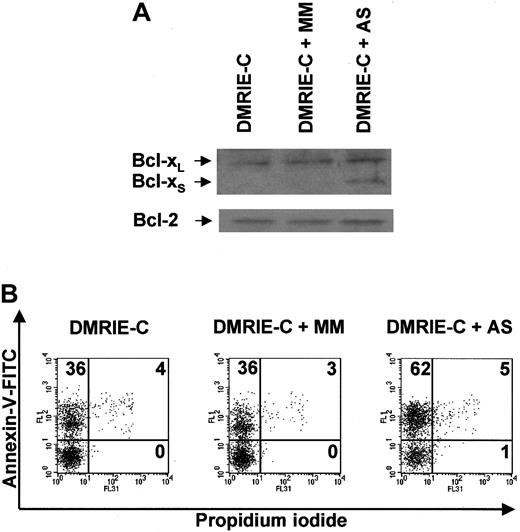 Fig. 8. Antisense ON-mediated induction of Bcl-xSexpression in human granulocytes leads to apoptosis. / Blood granulocytes were isolated from buffy coats by density centrifugation and treated for 8 hours with DMRIE-C alone (24 μL per 2 × 106 cells) or DMRIE-C combined with AS (or MM) ONs designed to redirect bcl-x pre-mRNA splicing towardbcl-xS (8 μg per 2 × 106cells). (A) Whole-cell extracts were analyzed by immunoblotting for Bcl-xL/S and Bcl-2. (B) Apoptosis assays were performed on treated granulocytes using dual-color annexin-V–FITC/PI staining and flow cytometry analyses. The percentage of single- or double-positive cells in the individual quadrants is shown. These results were representative of at least 3 comparable experiments.