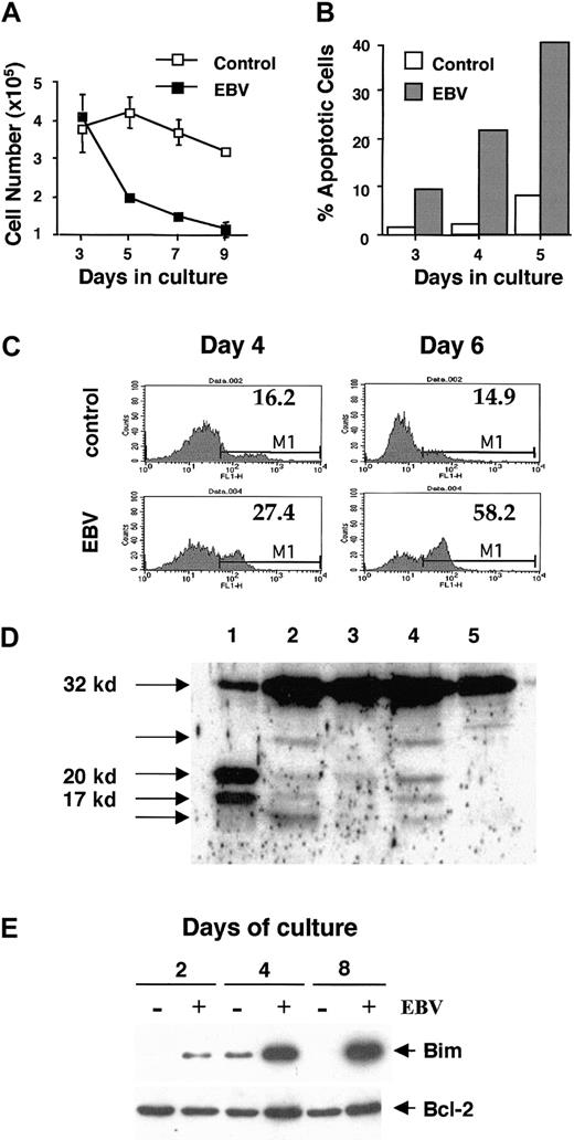 Fig. 1. EBV infection induces apoptosis of monocytes cultured in GM-CSF and IL-4. / Monolayers of adherent PBMCs or purified CD14+monocytes were infected with supernatants from the EBV producer B95.8 cell line for 2 hours at 37°C and were cultured in medium with or without GM-CSF and IL-4. Each culture condition was tested in triplicate in every experiment. (A) Time kinetics of cell recovery in control (open symbols) and EBV-infected cultures (closed symbols) containing GM-CSF and IL-4. Mean ± SD of triplicates. Results are from 1 of 20 representative experiments. (B) Cytospins of cells cultured for 5 days in GM-CSF and IL-4 were examined by phase-contrast microscopy and Hoechst staining. From day 3, the percentage of apoptotic cells was significantly higher in EBV-infected cultures (gray bars) than in the uninfected control (white bars) and increased in parallel with the decrease of cell recovery. Results are from 1 of 2 representative experiments. (C) FACS analysis of FITC-conjugated Annexin V binding to EBV-infected and control cells collected at day 4 or day 6 of culture. Gated populations of propidium iodide-negative cells are shown. Values inside the histogram plots represent the percentage of gated cells in the M1 region. Results are from 1 of 2 representative experiments. (D) Caspase-3 cleavage in EBV-infected cells. Total cell lysates of EBV peptide-specific antigen-activated cytotoxic T-cell clone BK289 (lane 1), EBV-infected (lanes 2 and 4), and control (lanes 3 and 5) monocytes collected at day 4 (lanes 2 and 3) or day 6 (lanes 4 and 5) of culture with the lymphokines were analyzed by immunoblotting with caspase-3–specific rabbit polyclonal antibody. The 20-kd and 17-kd products, corresponding to enzymatically active forms of caspase-3 and generated by cleavage of 32-kd proenzyme, are easily detectable in the T-cell lysate because of Fas triggering.39 The same products are seen in the lysates of EBV-infected cells but not in control cells. The band of lower molecular weight most likely represents the enzymatically inactive 12-kd small subunit of caspase-3.4041 Identity of the fragment with the highest molecular weight remains uncertain. (E) Expression of Bim and Bcl-2 proteins in control (EBV−) or EBV-infected (EBV+) cultures was analyzed by immunoblotting after the indicated periods of time.