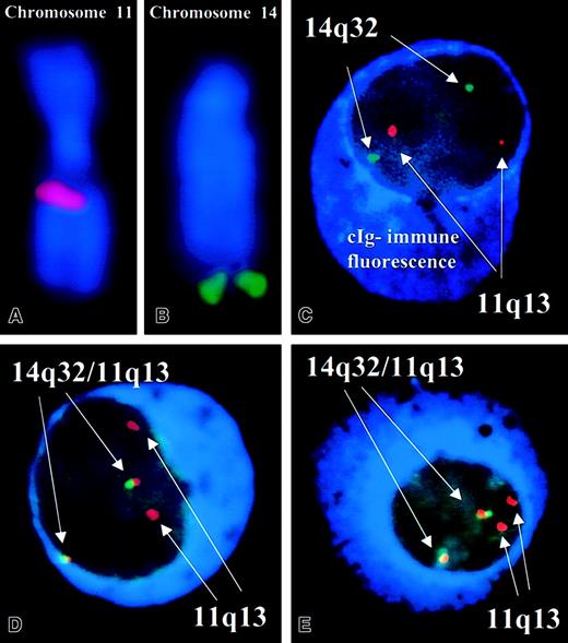 Fig. 1. Patterns of FISH probes used in this study. / (A,B) The correct localization of the pool of probes to chromosomes 11 and 14, respectively. (C) A plasma cell without evidence of a t(11;14)(q13;q32). There are 2 pairs of discrete red and green signals and no fusion signals. The plasma cells can be easily distinguished by the intense blue fluorescence of the cytoplasm. (D) An abnormal plasma cell with 2 fusion signals resulting from the comigration of probes and indicative of a t(11;14)(q13;q32). (E) Another abnormal cell (Leica DMRXA). Original magnification, × 63. DAPI counterstain in panels A and B. cIg-FISH on panels C-E.
