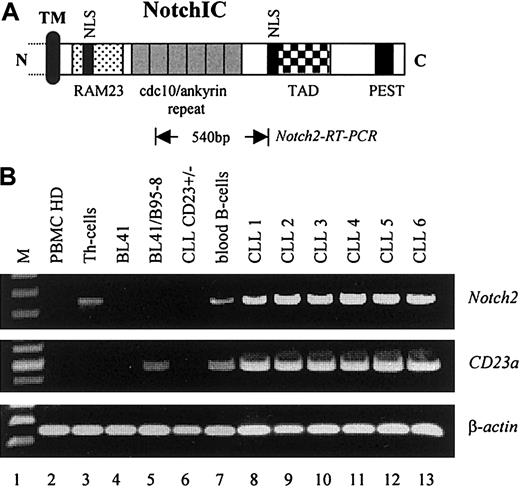 Fig. 4. Notch2 is overexpressed in B-CLL cells. / (A) Relative position of the Notch2 sequence (Notch2-RT-PCR) used for mRNA detection. The intracellular domain of Notch is characterized by the RAM23 domain and 6 copies of a cdc10/ankyrin motif, known to bind CBF1 (TM, transmembrane domain; NLS, nuclear localization signals; TAD, transactivation domain; PEST, protein degradation signal). (B) RT-PCR analysis indicating that Notch2 is overexpressed in B-CLL samples where it correlates with the expression of CD23a(PBMCs, Th cells, and peripheral blood B-cells from healthy donors are representative for n = 3). β-Actin was used as an internal control.