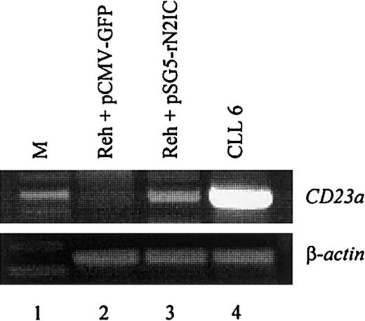 Fig. 5. Notch2IC induces endogenous. / CD23a in B cells. The CD23−pre–B-cell line REH was transiently transfected with pSG5-rN2IC, coding for the intracellular domain of rat Notch2. After 48 hours of incubation, total RNA was subjected to RT-PCR analysis that demonstrated that rNotch2IC induces CD23a transcription (lane 3). Lane 2 shows a control transfection experiment with pCMV-GFP. B-CLL cells (lane 4) served as positive control for CD23aexpression.