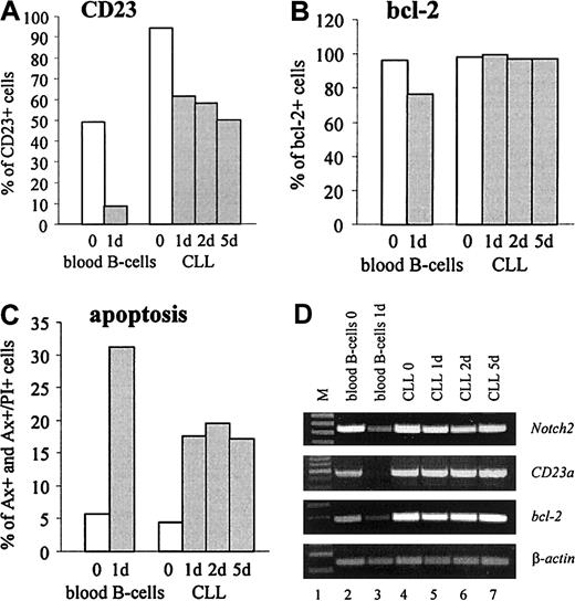 Fig. 6. CD23a is differently regulated in B-CLL cells compared with normal B lymphocytes. / In vitro expression kinetic studies demonstrating that in B-CLL cells CD23a levels remain high during 5 days of incubation under serum-free conditions, whereas in normal B-cellsCD23a is down-regulated within 24 hours. (A-C) FACS analysis showing the percentage of CD23, bcl-2, and early and late apoptotic cells (Annexin V+ and Annexin V+/propidium iodide+, respectively). (D) RT-PCR analysis correlating the expression of Notch2 with CD23a andbcl-2.
