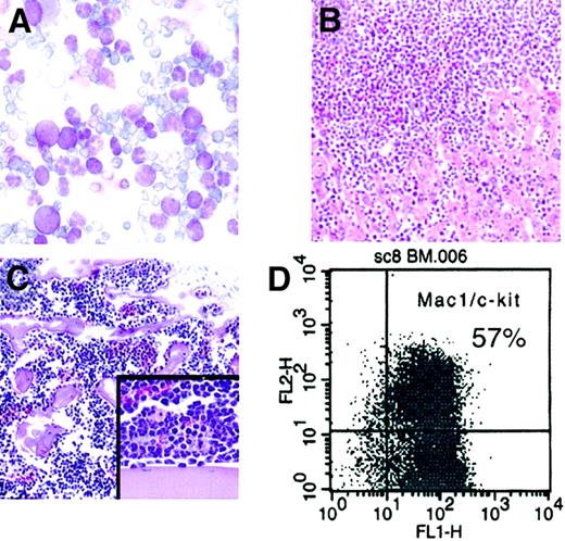 Fig. 3. MLL-AF10immortalized cells are leukemogenic. / (A) May-Grünwald/Giemsa–stained cells from peripheral blood show hyperleukocytosis with myeloblasts (× 50). (B) BM aspirate shows monotonous population of mononuclear cells (hematoxylin and eosin stain, × 10). (C) Liver displays extensive infiltration by blasts (hematoxylin and eosin stain, × 10; insert, × 20). (D) Fluorescence-activated cell sorter analysis of leukemia cells shows that most cells coexpress the surface antigens Mac1 and c-kit.