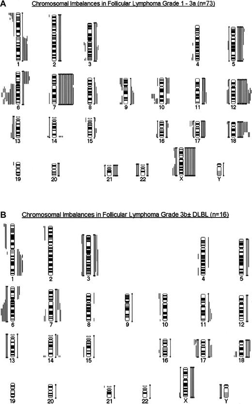Fig. 3. Summary of chromosomal imbalances. / FL grade 3a (A) and FL 3b ± DLBL (B). Lines on the left of the ideogram depict chromosomal losses, whereas lines on the right symbolize chromosomal gains. Closed bars represent monosomies and trisomies.