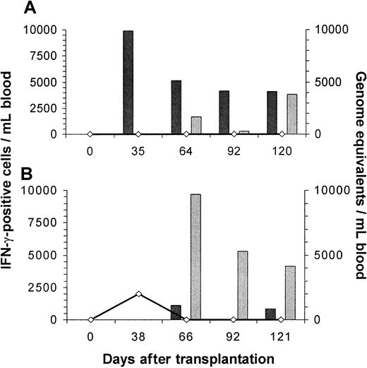 Fig. 2. Correlation of viral load in the blood and reconstitution of HCMV-specific, HLA-A*0201– and HLA-B*0702–restricted CTLs in 2 patients after allogeneic SCT. / Peptide-specific CD8+ CTLs were analyzed by intracellular IFN-γ staining with flow cytometry after specific stimulation, and viral load was assessed by quantitative PCR. Black bars indicate HLA-A*0201–restricted CTLs and gray bars HLA-B*0702–restricted CTLs; the black line and open diamonds represent viral load. Early reconstitution of predominantly HLA-A*0201–restricted CTLs in patient 1 was associated with complete suppression of HCMV replication after allogeneic SCT (A). Patient 9, who was given a transplant of highly purified stem cells from a 1-Ag–mismatched family member (A3 A2), showed early reconstitution of HLA-B*0702–restricted CTLs associated with rapid clearance of the viral DNA from the blood (B). However, HLA-A*0201–restricted CTLs were detectable just above the lower detection limit on 2 occasions. Values are the absolute numbers of peptide-specific CTLs/mL blood.