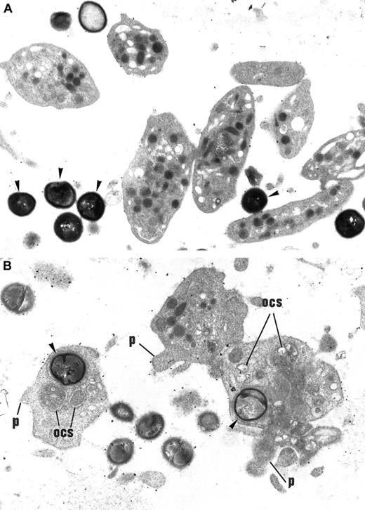 Fig. 1. Effect of ADP on S aureus internalization by platelets. / (A) Washed control platelets incubated with a S aureus suspension. Platelets remain discoid and fully granulated, displaying no morphological signs of activation. Bacteria (arrowheads) remain in the extracellular space and are not internalized within platelets. Original magnification, × 14 040. (B) Washed platelets stimulated with 10 μM ADP and incubated with S aureus. Some bacteria (arrowheads) have been internalized by platelets. These platelets present signs of morphological activation: loss of discoid shape, extension of small pseudopods (p), dilated OCS, disappearance of cytoplasmic granules. Original magnification, × 14 040.