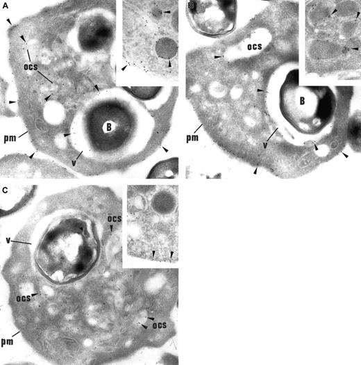 Fig. 2. Immunogold labeling of thrombin-activated platelets incubated with. / S aureus. (A) In platelets containing bacteria (B), αIIbβ3 labeling (arrowheads) is prominent along the plasma membrane (pm) and the OCS membrane. Like OCS, the limiting membrane of the engulfing vacuoles (v) is heavily labeled. Original magnification, × 23 250. Inset: In control platelets, αIIbβ3 is immunodetected along the plasma membrane and the α-granule membrane. Inset original magnification, × 34 100. (B) P-selectin (arrowheads) is consistently detected along the plasma membrane (pm) and the OCS, as expected, following platelet activation. The membrane of the engulfing vacuoles surrounding the bacteria is also labeled for P-selectin. Original magnification, × 23 250. Inset: In control platelets, P-selectin is restricted to the α-granular membrane and is absent from plasma membrane. Inset original magnification, × 34 100. (C) GPIb (arrowheads), which is immunodetected on the OCS membrane, is not found within the membrane of the engulfing vacuoles, showing that this compartment is distinct from the OCS. Noteworthy, GPIb is absent from the plasma membrane (pm), showing its redistribution into the OCS, a distribution pattern that is well established in activated platelets. Original magnification, × 23 250. Inset: In control platelets, GPIb is located mainly on the plasma membrane. Inset original magnification, × 34 100.