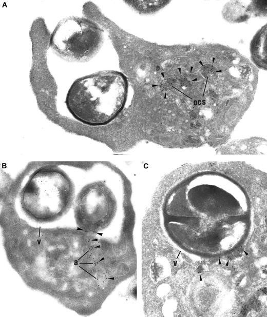Fig. 3. Thrombin-activated platelets incubated with S aureus, immunolabeled for fibrinogen (arrowheads). / (A) Platelet pseudopods surround the particle by a process of circumferential adherence. Fibrinogen release in OCS indicates platelet activation. Original magnification, × 37 200. (B) Several α-granules (a) fuse together and their fibrinogen content is released into the engulfing vacuole (v). Original magnification, × 27 900. (C) The α-granule fibrinogen is detected within the engulfing vacuole, in close contact with the bacterium. Original magnification, × 44 950.