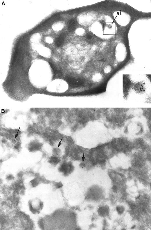 Fig. 5. Immunogold detection of HIV on ultrathin cryosections. / (A) In platelets incubated with the supernatant of HIV-infected cultured PBMCs, immunogold labeling for the HIV core protein p24 can specifically and sensitively identify a virionlike particle (vi) that has been internalized in the platelet. This allows its definite identification as an HIV particle. Virtually no background labeling is observed. Original magnification, × 40 250; inset original magnification, × 86 250. (B) Immunogold labeling for p24 was applied on the supernatant of HIV-infected cultured PBMCs: viral particles (arrows) are rare and are scattered among abundant cellular debris. Original magnification, × 46 200.